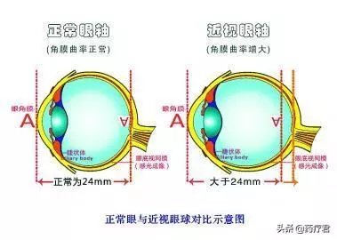 眼保健操有沒有用?眼科醫生:做對了絕對有用!