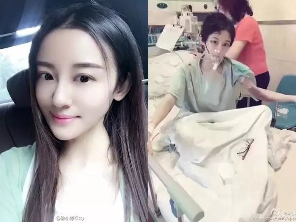 26歲女演員確診罹癌竟讓她大呼「終於要解脫了!」,昨天她不幸離世...「生前的慘痛遭遇」才被爆出!