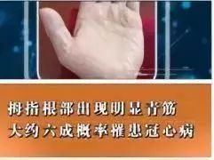 身體好不好,看手就知道!這些地方出現青筋,要小心了