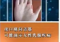 身體好不好,看手就知道!這些地方出現青筋,要小心了