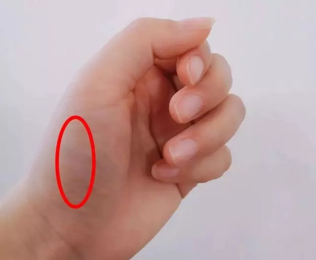 身體好不好,看手就知道!這些地方出現青筋,要小心了