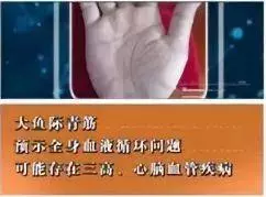 身體好不好,看手就知道!這些地方出現青筋,要小心了
