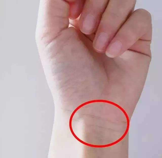 身體好不好,看手就知道!這些地方出現青筋,要小心了