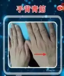 身體好不好,看手就知道!這些地方出現青筋,要小心了
