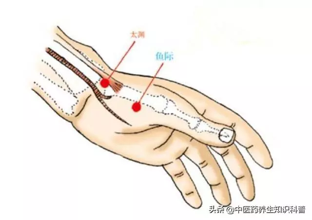 糖尿病血糖偏高怎麼辦?不妨試試按壓這4個穴位