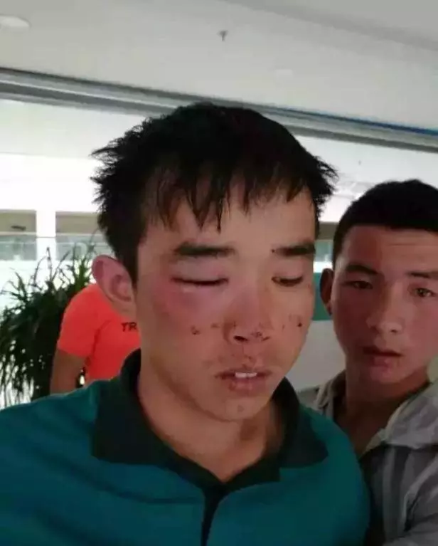 遲到五分鐘...快遞員被打致大小便失禁!打人者...「我生理期!」??