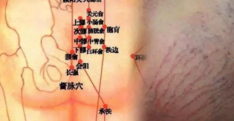 她每天拍打這個部位10分鐘,三天後竟然開始排黑便,一個月後更是出現驚人的變化...,太神奇了,一定要試試看!!!