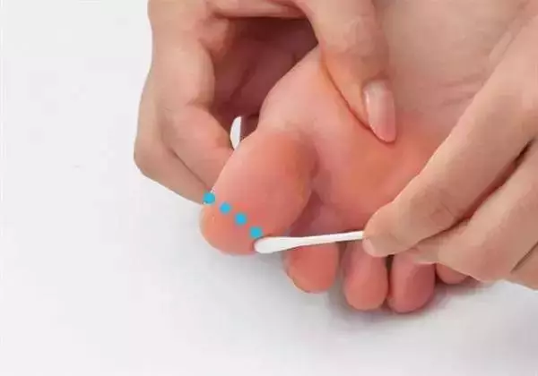 一根棉簽解決身上各種酸痛,立馬感覺無比舒暢!