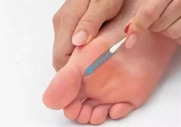 一根棉簽解決身上各種酸痛,立馬感覺無比舒暢!