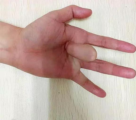 血壓升高,心絞痛,頭脹,心慌,打嗝,找准點按位置,1分鐘起效