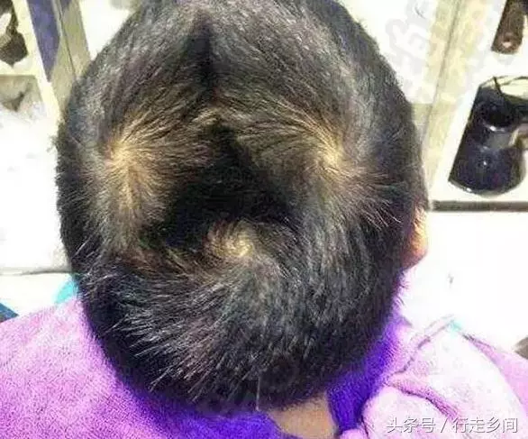 頭 上 幾 個 旋 的 人 命 好?真的准!
