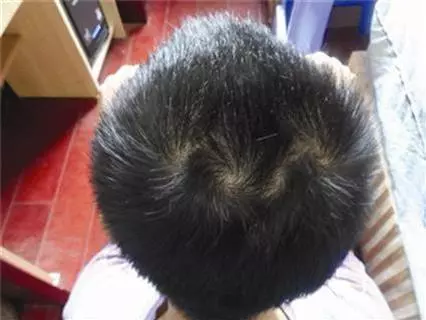 頭 上 幾 個 旋 的 人 命 好?真的准!
