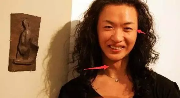 為保命放棄形象,不再服用激素藥物,金星51歲快要變成老爺爺!