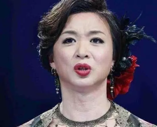 為保命放棄形象,不再服用激素藥物,金星51歲快要變成老爺爺!