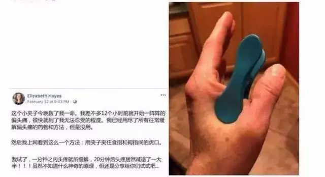 這個小夾子今晚救了我一命,一分鐘緩解頭痛?小偏方震驚外國網友