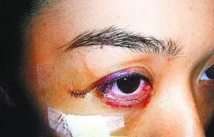 被陳凱歌稱為「兩岸三地第一美人」,嫁入豪門後,一年遭7次家暴!