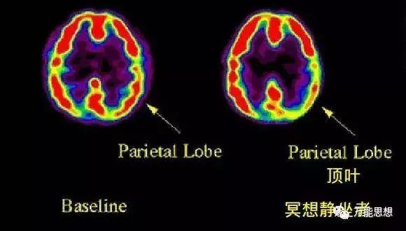 冥想真的可以改變大腦功能嗎?