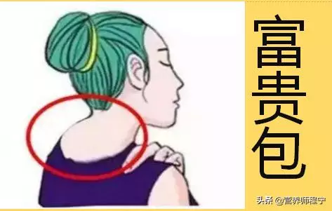 頸椎上的富貴包,消滅其實很簡單,僅需4步