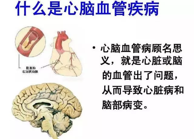 春天來了,教你五招應對心腦血管疾病。很有用哦!