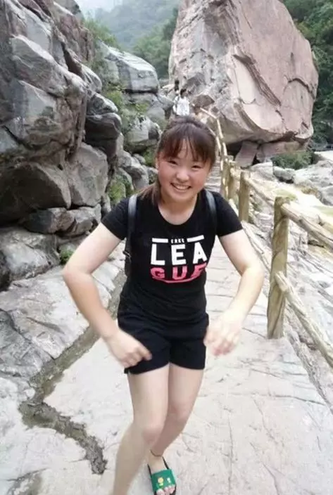別告訴她!17歲愛女被火燒80%灼傷「爸爸都沒去醫院看她」…事實讓網友爆哭
