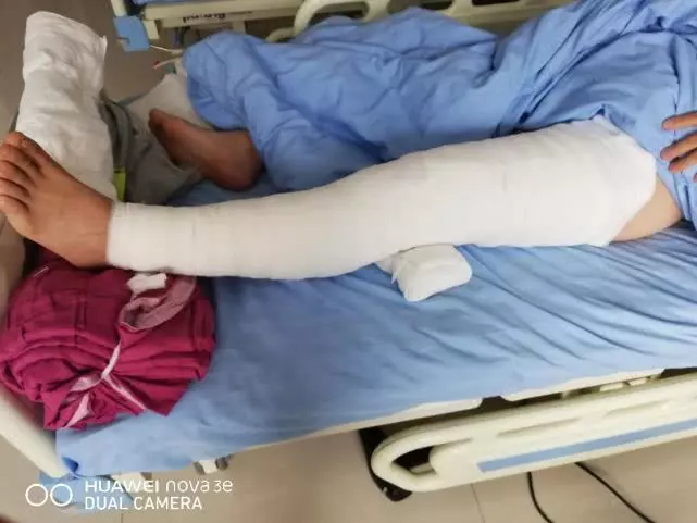 別告訴她!17歲愛女被火燒80%灼傷「爸爸都沒去醫院看她」…事實讓網友爆哭