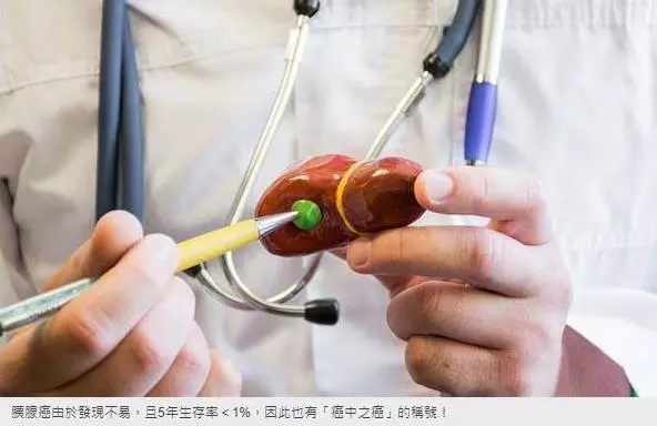別再喝含糖飲料了,臺灣胰腺癌併發率超9成,平均每秒奪走5.5條人命