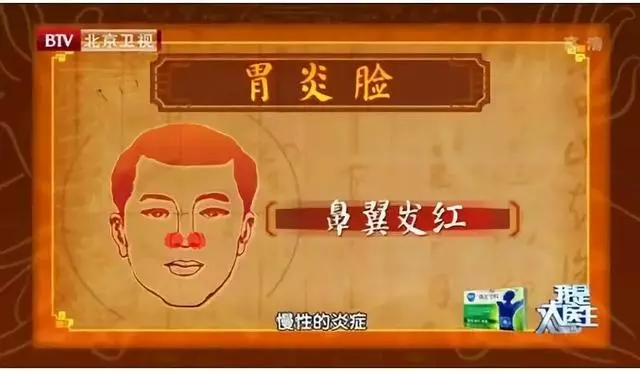 身體好不好,看臉就知道!國家級名老中醫公開講授秘訣,太多人受益!