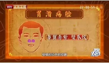 身體好不好,看臉就知道!國家級名老中醫公開講授秘訣,太多人受益!