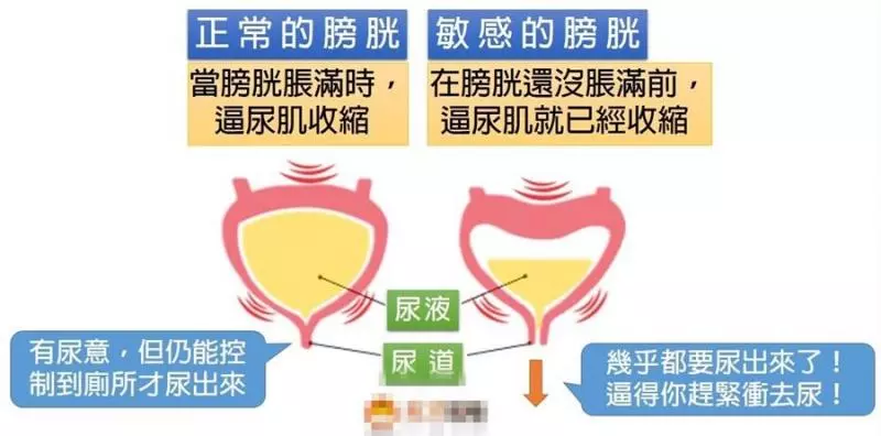 小孩夜尿,怎麼戒晚上尿布?三個方法教給你