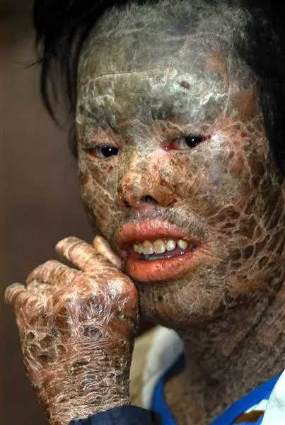 奇聞異事!世界上最恐怖的50種怪病,肚子竟然上長了...!!(多圖)