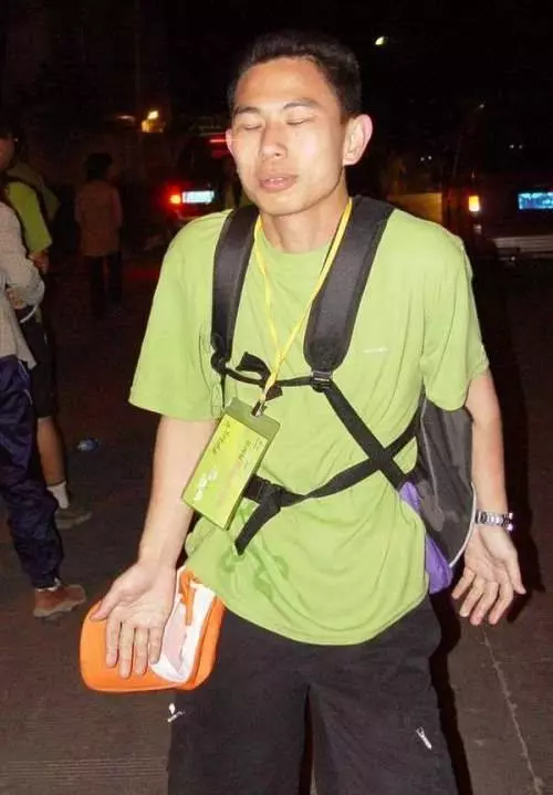 奇聞異事!世界上最恐怖的50種怪病,肚子竟然上長了...!!(多圖)