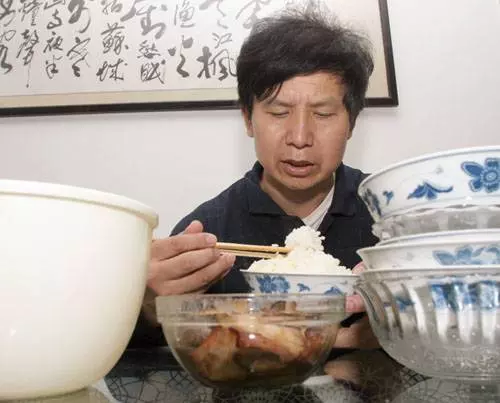 奇聞異事!世界上最恐怖的50種怪病,肚子竟然上長了...!!(多圖)