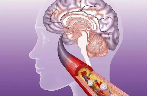 腎病患者每天堅持吃1個雞蛋,90天後化驗膽固醇,甘油三酯和膽固醇的變化,讓醫生都驚訝了