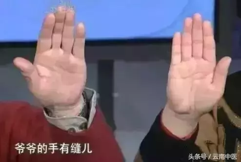 肝髒好不好,看中指根!