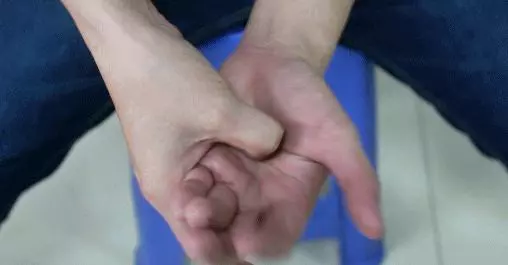 腸胃好不好,手掌有「提示」,伸手出來看看,自己是不是腸胃差