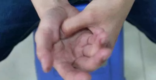 腸胃好不好,手掌有「提示」,伸手出來看看,自己是不是腸胃差
