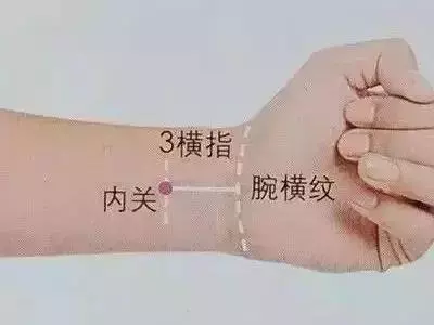【中醫康復】按揉內關穴巧治心律失常