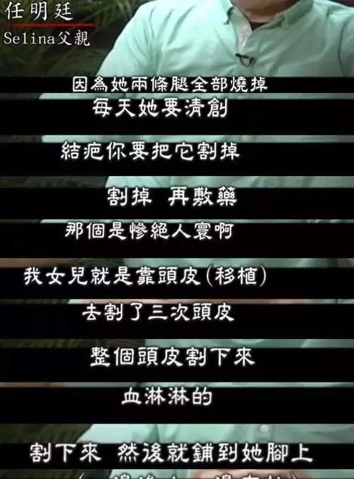Selina前夫稱見到她的傷處就想吐,用十年看清一個渣男到底虧不虧 ?!