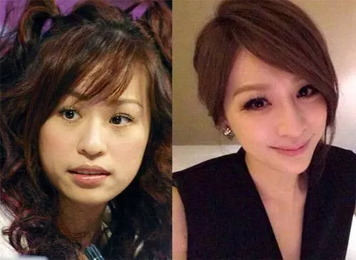 王心凌近照又變樣,臉部越整越僵,如今還撞臉劉嘉玲,簡直一言難盡,網友:還我當初那個甜心教主~