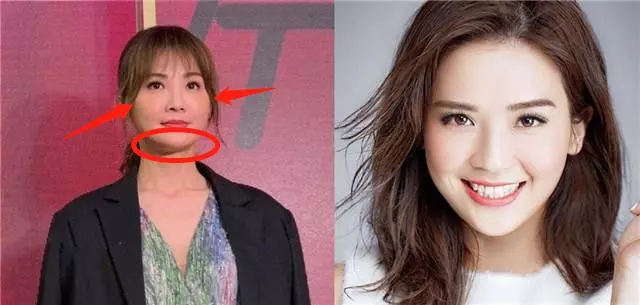 阿Sa疑因雪卵身材發福臃腫,現身活動造型老氣面如蠟像!