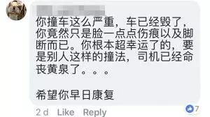 【喪盡天良 · 撞人逃跑!】大馬女網紅遭無良司機撞後逃跑,最終破相又斷腿!網紅:「希經過爆出...