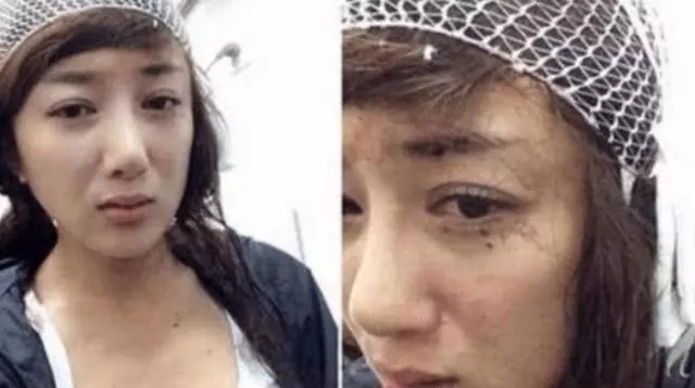 她曾是古裝第一美人,卻被葉璇的狗咬「毀容」,整容3次仍沒翻身