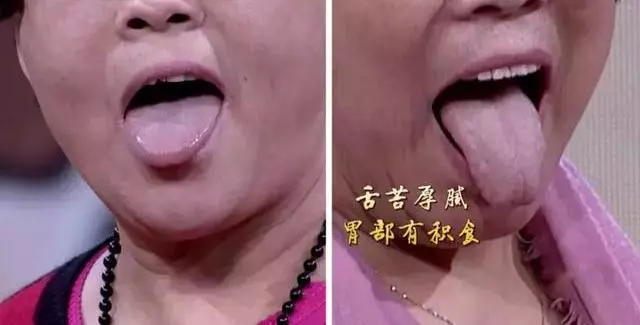 長壽老國醫,每天躺著動一動,無病無痛又長壽,還不花錢~