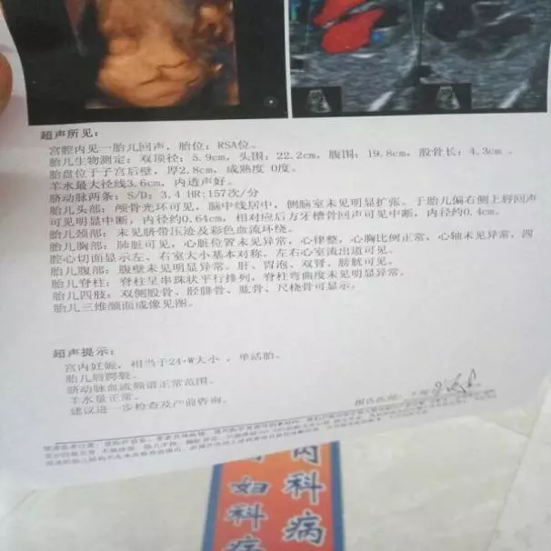 產檢胎兒是兔唇,媽媽堅持把他生下,幾個月後孩子變化令人驚喜