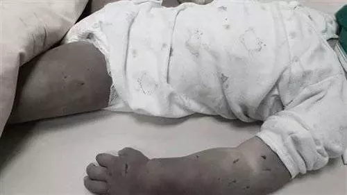 好可憐的女童◤台南女童被虐死案◢ 女嬰打翻奶 17歲母用「不求人」打死她