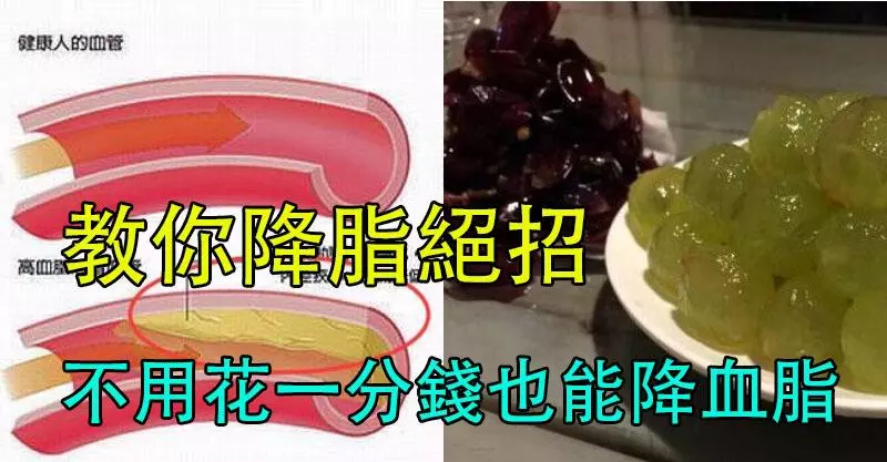 心血管專家教你「降脂絕招」,不用花一分錢也能「降血脂」!堅持一周,見效快,絕對值得收藏!