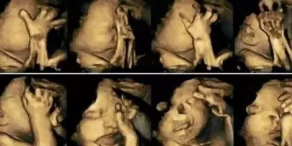 孕婦做彩色超音波,胎兒卻不停做鬼臉!她誇孩子是天才,醫生卻冷回:「打掉吧」!