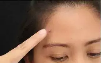內臟在求救!心、肝、脾、肺、腎五臟之毒如何排?對症防病!