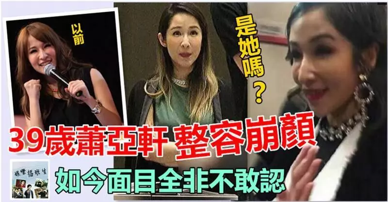 39歲天后蕭亞軒整容崩顏....! 如今面目全非不敢認 !!