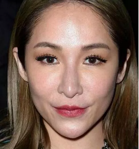 39歲天后蕭亞軒整容崩顏....! 如今面目全非不敢認 !!